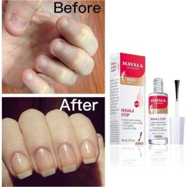 Mavala Stop Deterrent Nail Polish Treatment | Nail Care to Help Stop Putting Fingers In Your Mouth | Bitter Taste | Easy Application | For Ages 3+ | 0.3 Fl Oz Mavala Stop Deterrent Nail Polish Treatment | Nail Care to Help Stop Putting Fingers In Your Mouth | Bitter Taste | Easy Application | For Ages 3+ | 0.3 Fl Oz
