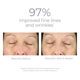 Derma E Anti-Wrinkle Renewal Skin Cream - Vitamin A Wrinkle Treatment Cream - Vegan Anti-Aging Moisturizer to Smooth & Renew Aging Skin, 4 oz