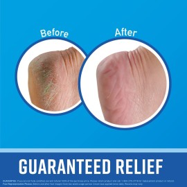 O\'Keeffe\'s for Healthy Feet Foot Cream; Guaranteed Relief for Extremely Dry; Cracked Feet; Instantly Boosts Moisture Levels; 3.2 Ounce Jar; (Pack of 1) O\'Keeffe\'s for Healthy Feet Foot Cream; Guaranteed Relief for Extremely Dry; Cracked Feet; Instantly Boosts Moisture Levels; 3.2 Ounce Jar; (Pack of 1)