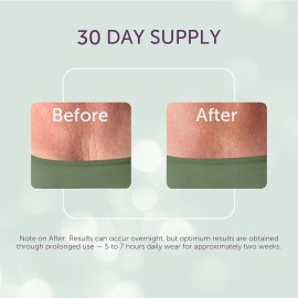 Silc Skin Decollette Pad - Medical-Grade Chest Wrinkle Pads, Smoothing Anti Wrinkle Chest Pads, Reusable Silicone Chest Wrinkle Patches, 30 Day Supply