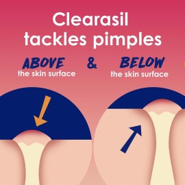 Clearasil Rapid Rescue Deep Treatment Acne Face Pads, Maximum Strenght with 2% Salicylic Acid Acne Treatment Medicine, 90 Count Clearasil Rapid Rescue Deep Treatment Acne Face Pads, Maximum Strenght with 2% Salicylic Acid Acne Treatment Medicine, 90 Count