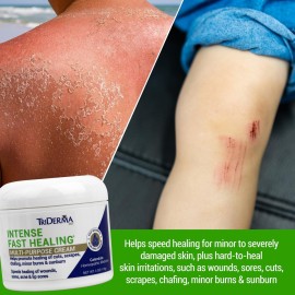 TriDerma Intense Fast Healing Cream, Decreases Healing Time for Minor Irritations, Rashes, Scrapes, Cuts 4 Ounces TriDerma Intense Fast Healing Cream, Decreases Healing Time for Minor Irritations, Rashes, Scrapes, Cuts 4 Ounces
