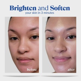 Cure by Toyo | Aqua Gel Gentle Exfoliator | Clear and Softer Skin | Non-Abrasive Face and Body Cleanser | Sensitive Skin | Big Size 8.82oz Cure by Toyo | Aqua Gel Gentle Exfoliator | Clear and Softer Skin | Non-Abrasive Face and Body Cleanser | Sensitive Skin | Big Size 8.82oz