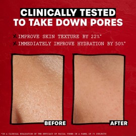 THAYERS Alcohol-Free, Hydrating, Unscented Witch Hazel Facial Toner with Aloe Vera Formula, Vegan, Dermatologist Tested and Recommended, 12 Oz (Packaging May Vary) THAYERS Alcohol-Free, Hydrating, Unscented Witch Hazel Facial Toner with Aloe Vera Formula, Vegan, Dermatologist Tested and Recommended, 12 Oz (Packaging May Vary)