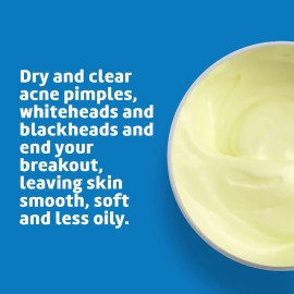 De La Cruz 10% Sulfur Ointment - Cystic Acne Treatment for Face and Body - Daily 10 Min Spot Treatment Mask Safe and Effective Game Changing Hormonal Acne Treatment that Clears Up Pimples 2.6oz 6 Pack