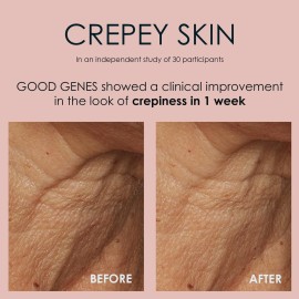 Sunday Riley Good Genes All-in-One Lactic Acid Treatment Face Serum 1.0oz Sunday Riley Good Genes All-in-One Lactic Acid Treatment Face Serum 1.0oz