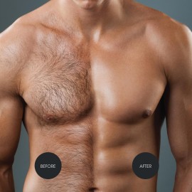 Nad\'s For Men Hair Removal Cream, Painless Hair Removal For Men, Soothing Depilatory Cream For Unwanted Coarse Male Body Hair, 6.8 Fl Oz Nad\'s For Men Hair Removal Cream, Painless Hair Removal For Men, Soothing Depilatory Cream For Unwanted Coarse Male Body Hair, 6.8 Fl Oz