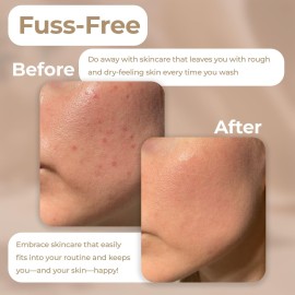 Vivo Per Lei Facial Peeling Gel - Contains Dead Sea Minerals and Nut Shell Powder - Gentle Face Exfoliator Scrub and Blackhead Remover - Peel Your Skin to a Fresher You - 3.4 Fl. Oz.