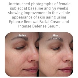 Epionce Renewal Facial Cream - Hydrating, Anti-Aging Moisturizer for Dry & Sensitive to Normal Skin, For Fine Lines & Wrinkles, Dermatologist Skincare