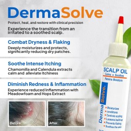 Dermasolve 4 oz Psoriasis, Seborrheic Dermatitis, & Dandruff Scalp Oil - Dermatologist Approved - Flaky Scalp Relief, Clinically Tested, Long-Lasting Itch-Free, High-Performance Formula