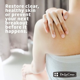 De La Cruz 10% Sulfur Ointment - Cystic Acne Treatment for Face and Body - Daily 10 Min Spot Treatment Mask - Safe and Effective Game Changing Hormonal Acne Treatment That Clears Up Pimples - 2.6 oz De La Cruz 10% Sulfur Ointment - Cystic Acne Treatment for Face and Body - Daily 10 Min Spot Treatment Mask - Safe and Effective Game Changing Hormonal Acne Treatment That Clears Up Pimples - 2.6 oz