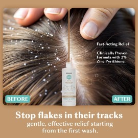 Zinc Shampoo, Dhs 16oz Zinc Shampoo, Dhs 16oz