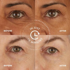 skyn ICELAND Hydro Cool Firming Under Eye Patches with Peptides and Coenzyme Q10 Instant Cooling Relief for Tired Puffy Eyes, 8 Pairs skyn ICELAND Hydro Cool Firming Under Eye Patches with Peptides and Coenzyme Q10 Instant Cooling Relief for Tired Puffy Eyes, 8 Pairs