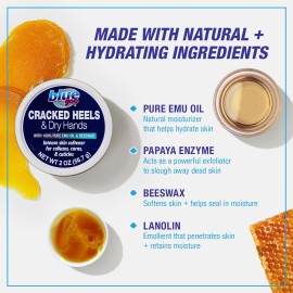 Blue Goo CRACKED HEELS & DRY HANDS Skin Softener for Dry Feet, Hands, Hydrating and Smoothing, Moisturizer, Dryness Relief, 2 Ounce, made with 100% PURE EMU OIL Blue Goo CRACKED HEELS & DRY HANDS Skin Softener for Dry Feet, Hands, Hydrating and Smoothing, Moisturizer, Dryness Relief, 2 Ounce, made with 100% PURE EMU OIL