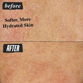 Kiehl\'s Ultra Facial Cream, with 4.5% Squalane to Strengthen Skin\'s Moisture Barrier, Skin Feels Softer and Smoother, Long-Lasting Hydration, Easy and Fast-Absorbing, All Skin Types - 1.7 fl oz Kiehl\'s Ultra Facial Cream, with 4.5% Squalane to Strengthen Skin\'s Moisture Barrier, Skin Feels Softer and Smoother, Long-Lasting Hydration, Easy and Fast-Absorbing, All Skin Types - 1.7 fl oz