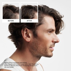 Nioxin Scalp + Hair Thickening System 2 Leave on Treatment | For Natural or Untreated Hair with Progressed Thinning | 3.4 Fl oz. Nioxin Scalp + Hair Thickening System 2 Leave on Treatment | For Natural or Untreated Hair with Progressed Thinning | 3.4 Fl oz.