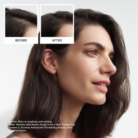 Nioxin System 3 Scalp + Hair Thickening Treatment | Serum for Colored or Damaged Hair with Light Thinning | 6.8 Fl oz. Nioxin System 3 Scalp + Hair Thickening Treatment | Serum for Colored or Damaged Hair with Light Thinning | 6.8 Fl oz.