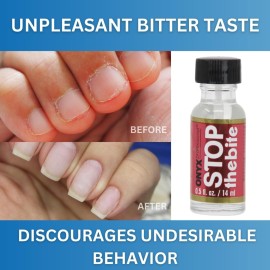 Onyx Professional Stop the Bite Nail Biting Deterrent Polish 0.5 Fl Oz - Helps Nails Grow & Can be Used as a Top or Base Coat Onyx Professional Stop the Bite Nail Biting Deterrent Polish 0.5 Fl Oz - Helps Nails Grow & Can be Used as a Top or Base Coat