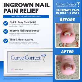 CurveCorrect Ingrown Toenail Corrector Kit - 10 Toenail Braces for Ingrown Toenail Treatment, Pain Relief, and Removal - at Home Big Toe Ingrown Nail Treatment Tool