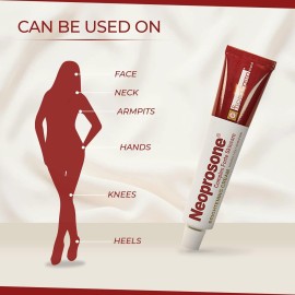 Neoprosone, Skin Brightening Cream | 1.7 Fl oz / 50 ml | Fade Dark Spots on: Face, Elbows, Knees, Body | with Alpha Arbutin, Lactic Acid, Castor Oil Neoprosone, Skin Brightening Cream | 1.7 Fl oz / 50 ml | Fade Dark Spots on: Face, Elbows, Knees, Body | with Alpha Arbutin, Lactic Acid, Castor Oil