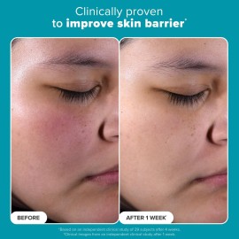 Paulas Choice--SKIN PERFECTING 2% BHA Liquid Salicylic Acid Exfoliant--Facial Exfoliant for Blackheads, Enlarged Pores, Wrinkles & Fine Lines, 4 oz Bottle Paulas Choice--SKIN PERFECTING 2% BHA Liquid Salicylic Acid Exfoliant--Facial Exfoliant for Blackheads, Enlarged Pores, Wrinkles & Fine Lines, 4 oz Bottle