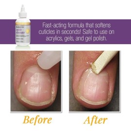 ProLinc Cuticle Eliminator, Softens and Removes Cuticles in Seconds, 4 oz ProLinc Cuticle Eliminator, Softens and Removes Cuticles in Seconds, 4 oz