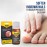 URIEL UPGRADED Ingrown Toenail Treatment, Ingrown Toenail Removal Kit, Ingrown Toenail Corrector, Ingrown Nail Kit Ingrown Toenail Tool 11 ml