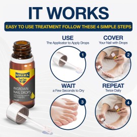URIEL UPGRADED Ingrown Toenail Treatment, Ingrown Toenail Removal Kit, Ingrown Toenail Corrector, Ingrown Nail Kit Ingrown Toenail Tool 11 ml URIEL UPGRADED Ingrown Toenail Treatment, Ingrown Toenail Removal Kit, Ingrown Toenail Corrector, Ingrown Nail Kit Ingrown Toenail Tool 11 ml