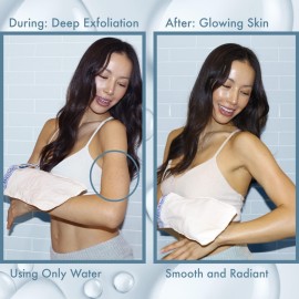 MicrodermaMitt Deep Exfoliating Mitt for Shower - Premium Dead Skin Remover & Exfoliator Body Scrubber - Turkish Kese Glove for Keratosis Pilaris - Natural Skin Care for Smooth, Radiant Results MicrodermaMitt Deep Exfoliating Mitt for Shower - Premium Dead Skin Remover & Exfoliator Body Scrubber - Turkish Kese Glove for Keratosis Pilaris - Natural Skin Care for Smooth, Radiant Results