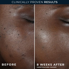 RoC Multi Correxion 5 in 1 Restoring/Anti Aging Facial Night Cream with Hexinol, 1.7 Ounces (Packaging May Vary) RoC Multi Correxion 5 in 1 Restoring/Anti Aging Facial Night Cream with Hexinol, 1.7 Ounces (Packaging May Vary)