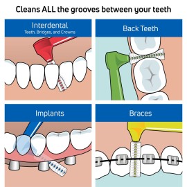 TEPE Interdental Brush Angle, Angled Dental Brush for Teeth Cleaning, Pack of 6, 0.45 mm, Extra-Small/Small Gaps, Orange, Size 1 TEPE Interdental Brush Angle, Angled Dental Brush for Teeth Cleaning, Pack of 6, 0.45 mm, Extra-Small/Small Gaps, Orange, Size 1