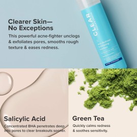 Paula\'s Choice CLEAR Extra Strength Exfoliator, 2% Salicylic Acid Exfoliant for Acne, Redness Relief, 4 Ounce Paula\'s Choice CLEAR Extra Strength Exfoliator, 2% Salicylic Acid Exfoliant for Acne, Redness Relief, 4 Ounce