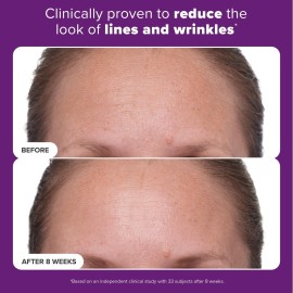 Paula\'s Choice CLINICAL 1% Retinol Treatment Cream with Peptides, Vitamin C & Licorice Extract, Anti-Aging & Wrinkles, 1 Ounce Paula\'s Choice CLINICAL 1% Retinol Treatment Cream with Peptides, Vitamin C & Licorice Extract, Anti-Aging & Wrinkles, 1 Ounce