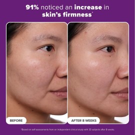 Paula\'s Choice CLINICAL 1% Retinol Treatment Cream with Peptides, Vitamin C & Licorice Extract, Anti-Aging & Wrinkles, 1 Ounce Paula\'s Choice CLINICAL 1% Retinol Treatment Cream with Peptides, Vitamin C & Licorice Extract, Anti-Aging & Wrinkles, 1 Ounce