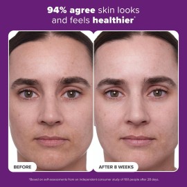 Paula\'s Choice CLINICAL 1% Retinol Treatment Cream with Peptides, Vitamin C & Licorice Extract, Anti-Aging & Wrinkles, 1 Ounce Paula\'s Choice CLINICAL 1% Retinol Treatment Cream with Peptides, Vitamin C & Licorice Extract, Anti-Aging & Wrinkles, 1 Ounce