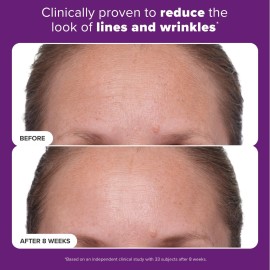 Paula\'s Choice CLINICAL 1% Retinol Treatment Cream with Peptides, Vitamin C & Licorice Extract, Anti-Aging & Wrinkles, Travel Size. PACKAGING MAY VARY.