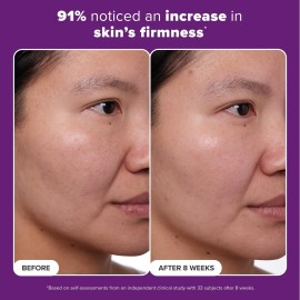 Paula\'s Choice CLINICAL 1% Retinol Treatment Cream with Peptides, Vitamin C & Licorice Extract, Anti-Aging & Wrinkles, Travel Size. PACKAGING MAY VARY.