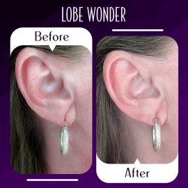 Lobe Wonder - The ORIGINAL Ear Lobe Support Patch for Pierced Ears - Eliminates the Look of Torn or Stretched Piercings - Protects Healthy Ear Lobes from Tearing - 60 Patches - Clear & Latex-Free Lobe Wonder - The ORIGINAL Ear Lobe Support Patch for Pierced Ears - Eliminates the Look of Torn or Stretched Piercings - Protects Healthy Ear Lobes from Tearing - 60 Patches - Clear & Latex-Free