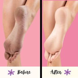 Mr. Pumice Purple PUMI Bar, Extra-Coarse Callus Remover, Pedicure Stone & Ped File Scrubber for Smooth Feet and Heels, 4 Pack Mr. Pumice Purple PUMI Bar, Extra-Coarse Callus Remover, Pedicure Stone & Ped File Scrubber for Smooth Feet and Heels, 4 Pack