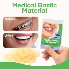 Orthodontic Elastic Rubber Bands - 3/16 Inch, Small, 100 Pack, (4.5 Ounce) for Braces, Dreadlocks, Hair Braids, Fix Tooth Gap, Includes Free Elastic Placer - Natural - Heavy