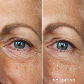 WUNDER2 Wunderlift Instant Eye Tightening Serum, Temporary Firming & Lifting Treatment in 60 Seconds, Reduces Under-Eye Bags, Dark Circles, Puffiness, Anti-aging Fine Lines WUNDER2 Wunderlift Instant Eye Tightening Serum, Temporary Firming & Lifting Treatment in 60 Seconds, Reduces Under-Eye Bags, Dark Circles, Puffiness, Anti-aging Fine Lines