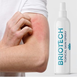 BRIOTECH Topical Skin Spray, Hypochlorous Acid Spray for Body & Face, Eyelid Cleanser, HOCl Facial Mist, Support Against Irritation and Redness, Packaging May Vary, 4 oz, 1 ct
