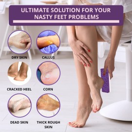 Love Natural Pumice Stone for Feet - Ultimate 2-in-1 Scrubber and Professional Exfoliating Rock for Feet Hands Body Care - Pumice Stone for Dead Skin & Callus Removal (Purple) Love Natural Pumice Stone for Feet - Ultimate 2-in-1 Scrubber and Professional Exfoliating Rock for Feet Hands Body Care - Pumice Stone for Dead Skin & Callus Removal (Purple)