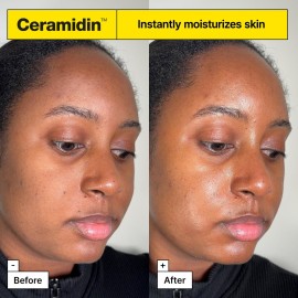 Dr.Jart+ Ceramidin Skin Barrier Face Cream Moisturizer For Dry Skin with Ceramides and Panthenol | Korean Skin Care, 1.69 Fl Oz Dr.Jart+ Ceramidin Skin Barrier Face Cream Moisturizer For Dry Skin with Ceramides and Panthenol | Korean Skin Care, 1.69 Fl Oz