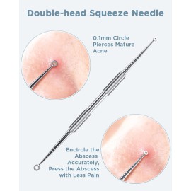 BESTOPE Blackhead Remover Blackhead Removal Pimple Comedone Extractor Tool - Treatment for Blemish Whitehead Popping Zit Removing with Metal Case (Silver)