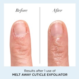 butter LONDON Cuticle Remover Liquid, Melt Away - Cuticle Oil Exfoliator & Softener Gently Removes Dry, Overgrown Cuticles for Healthy Looking Nails - Fast-Acting & Pain-Free Formula - 0.4 Fl Oz butter LONDON Cuticle Remover Liquid, Melt Away - Cuticle Oil Exfoliator & Softener Gently Removes Dry, Overgrown Cuticles for Healthy Looking Nails - Fast-Acting & Pain-Free Formula - 0.4 Fl Oz