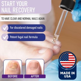 ZanaQuick Extra Strength Toenail & Fingernail Repair Drops - Nail Care Renewal for Thick, Damaged & Discolored Nails - 2 Pack ZanaQuick Extra Strength Toenail & Fingernail Repair Drops - Nail Care Renewal for Thick, Damaged & Discolored Nails - 2 Pack