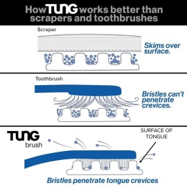 Tung Tongue Brush & Gel Kit | Tongue Cleaner for Adults | Tongue Scraper to Fight Bad Breath and Halitosis | Mouth Odor Eliminator | Fresh Mint | Made in America (Set of 1) Tung Tongue Brush & Gel Kit | Tongue Cleaner for Adults | Tongue Scraper to Fight Bad Breath and Halitosis | Mouth Odor Eliminator | Fresh Mint | Made in America (Set of 1)