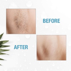 Clean + Easy Electrolysis Machine for Permanent Hair Removal - Non-Laser, Painless Electrolysis Hair Removal for Face & Body, At-Home Remover Device Clean + Easy Electrolysis Machine for Permanent Hair Removal - Non-Laser, Painless Electrolysis Hair Removal for Face & Body, At-Home Remover Device