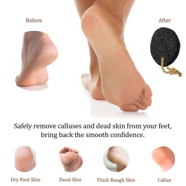 Pumice Stone - Natural Earth Lava Black - Callus/Corn Remover for Feet Heels and Palm - Pedicure Exfoliation Tool - Dry Dead Skin Scrubber - Health Foot Care Pumice Stone - Natural Earth Lava Black - Callus/Corn Remover for Feet Heels and Palm - Pedicure Exfoliation Tool - Dry Dead Skin Scrubber - Health Foot Care